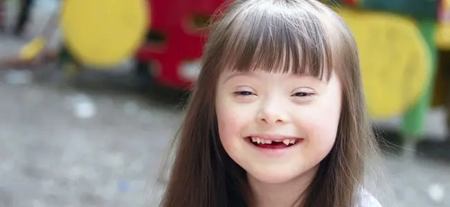 Niños con síndrome de Down