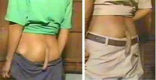 Atavismo en humanos, organos y conductas vestigiales Atavismo en humanos, organos y conductas vestigiales