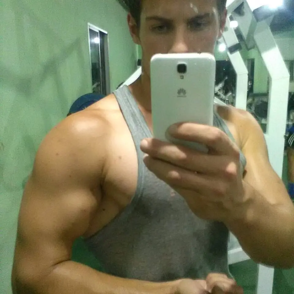 Obesidad Obesidad