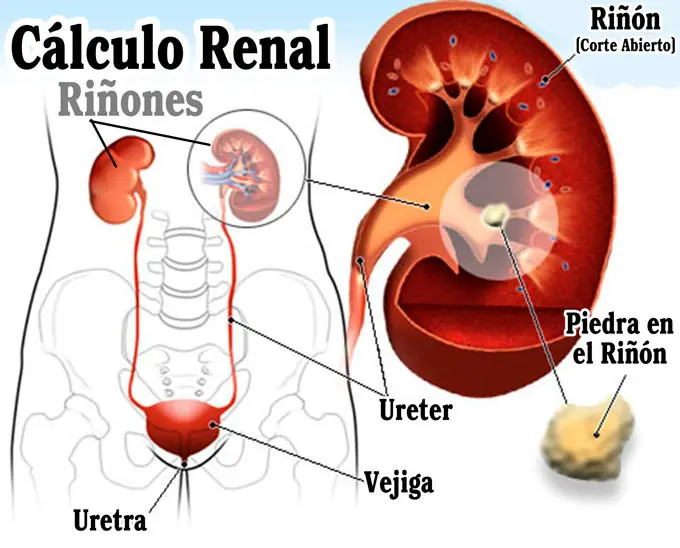 tratamiento