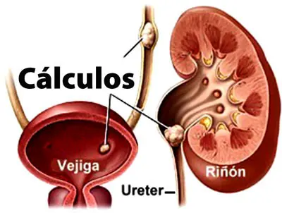 consejos