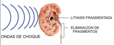 tratamiento