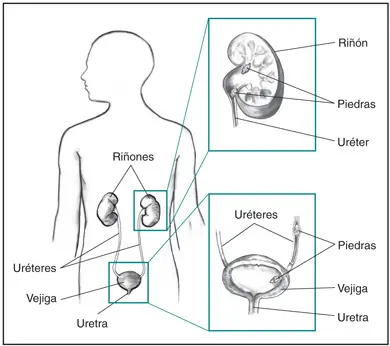sintomas