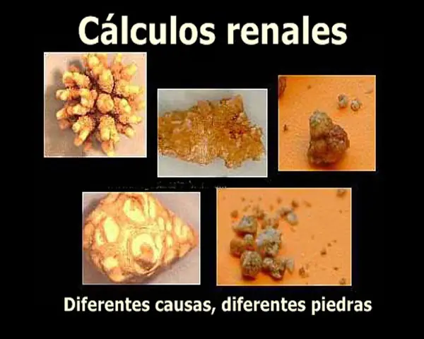 tipos