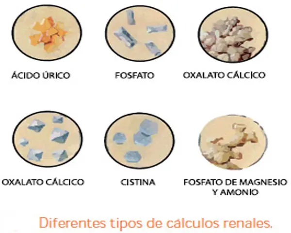 consejos