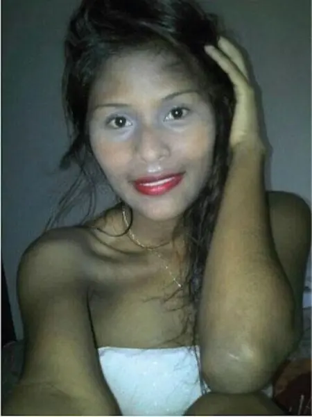 ojeras
