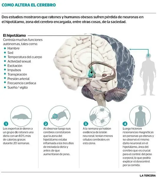 Infografias de las neuronas y el cerebro