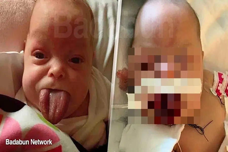 Su lengua no para de crecer, no imaginas lo que hizo su mama