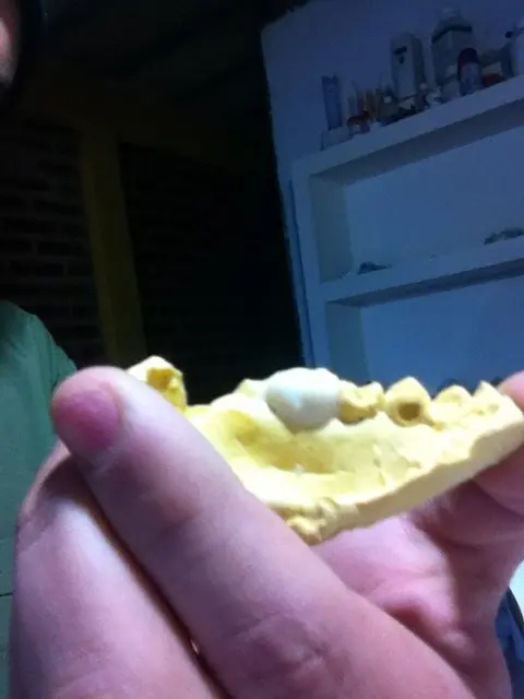 provisorios