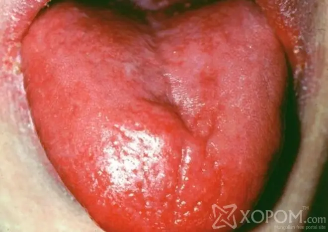de salud