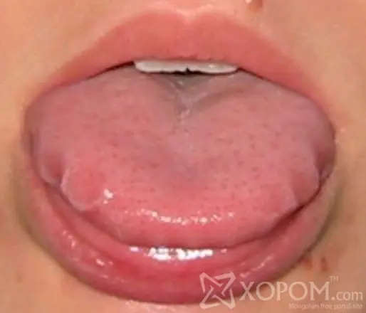 Detecta problemas de salud examinando tu lengua