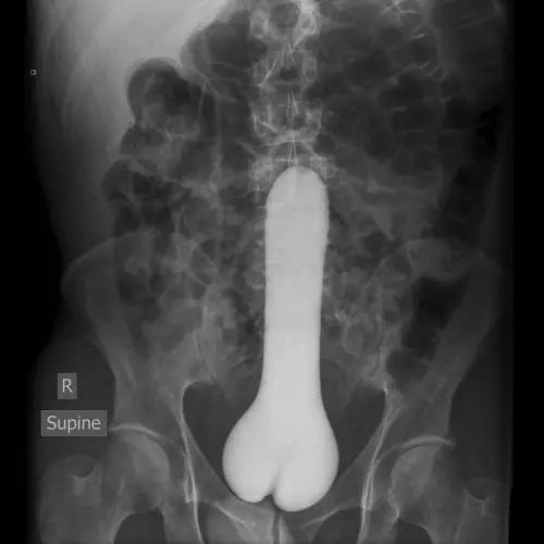 cuerpo humano