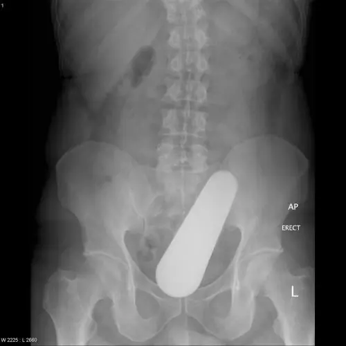 radiografia