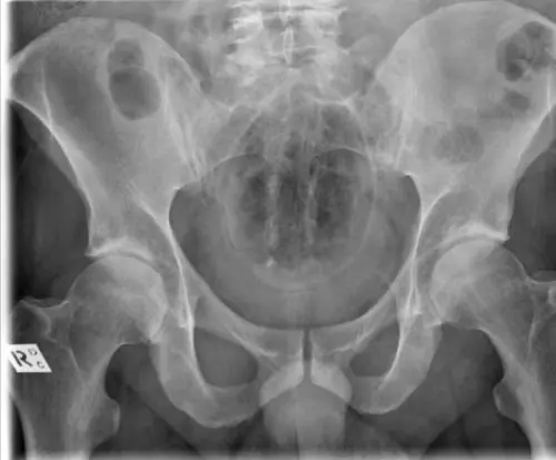 radiografia