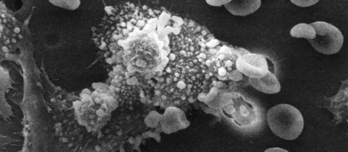 La causa principal de cáncer: alimentos con agroquímicos