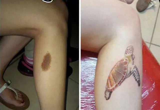los