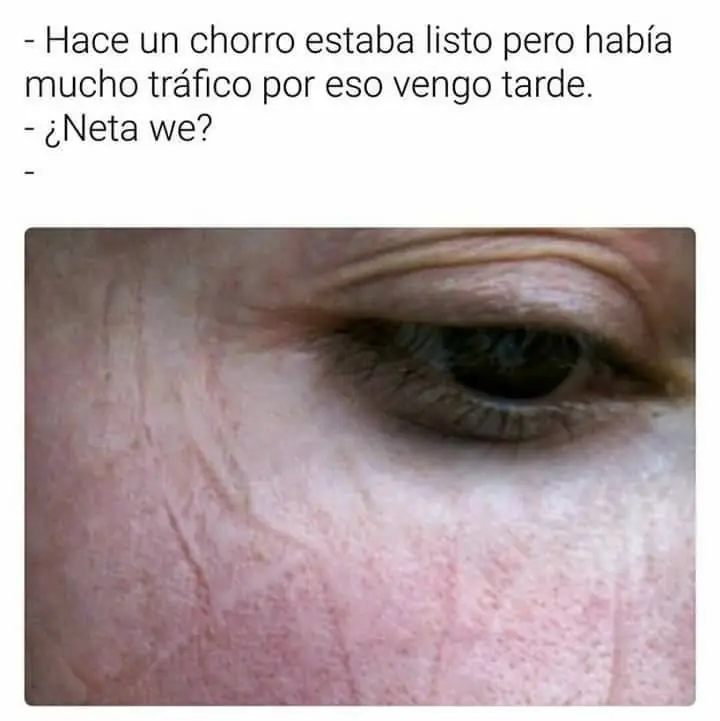imagenes