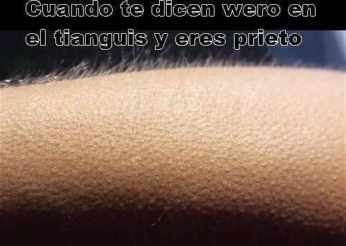 imagenes