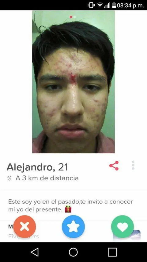 imagenes