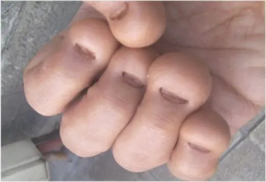 Nunca más volverás a morderte las uñas ¡Descubre 11 razones!