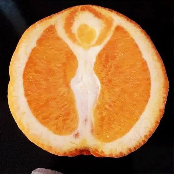 imagenes