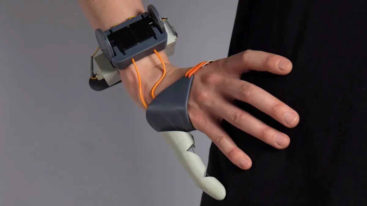 ¿Le agregarías un nuevo dedo a tu mano?