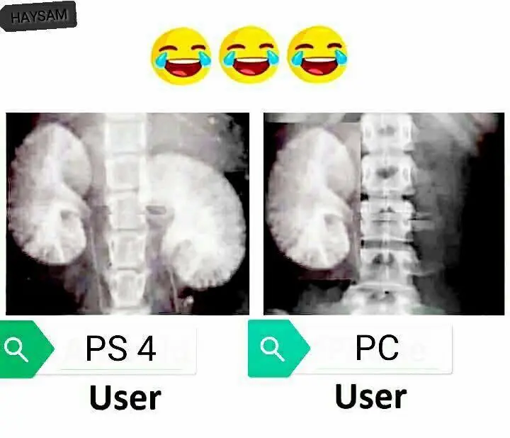 fotos