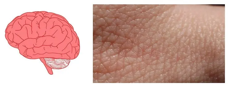Medula