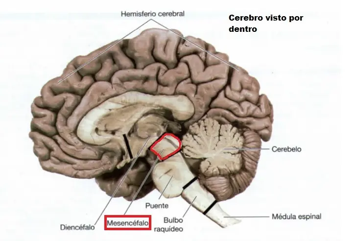 sangre