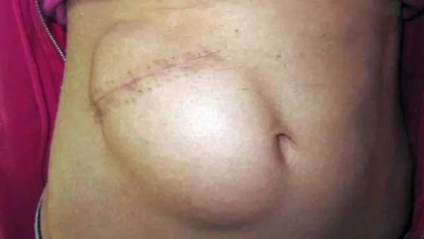 No creerás lo que esconde est reina d belleza en su estómago