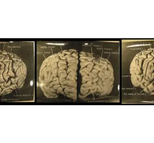 cerebro