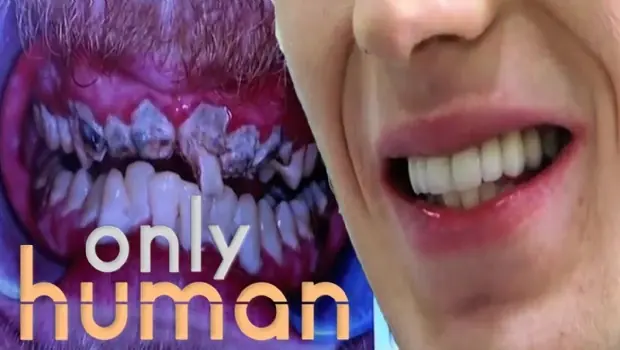 los dientes