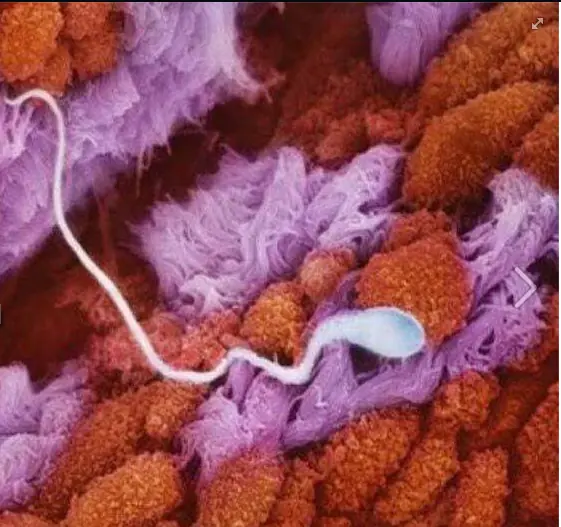 espermatozoides