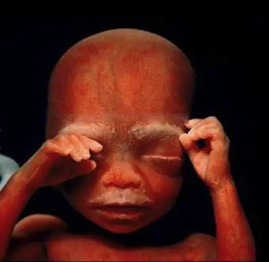 nacimiento de un bebe