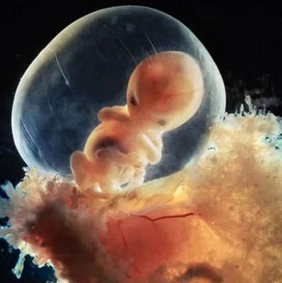 nacimiento de un bebe