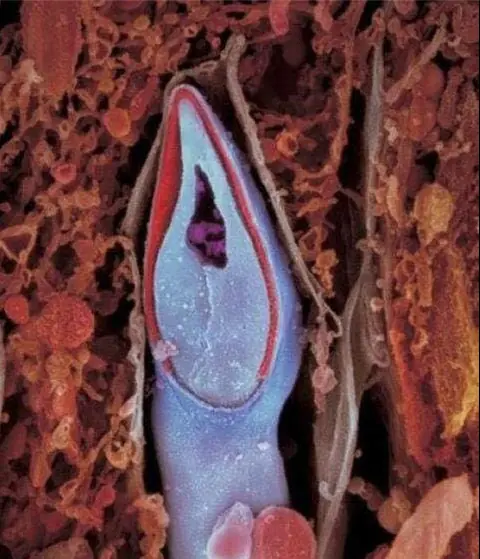 nacimiento de un bebe