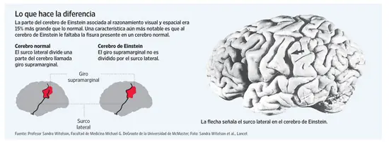 cerebro