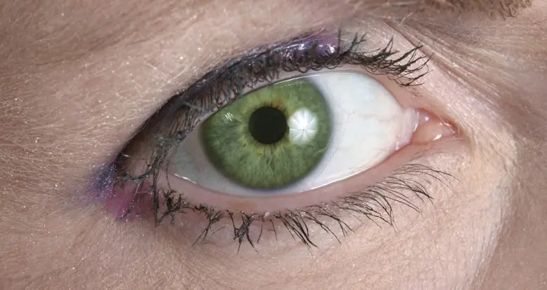 Los 8 colores de ojos más raros del mundo