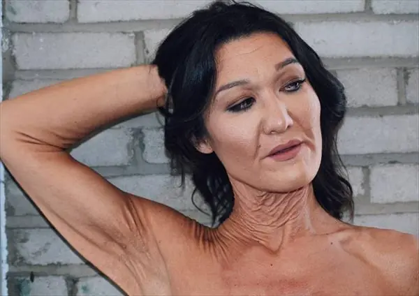 Modelo exhibe su rara condición de piel