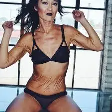 rara