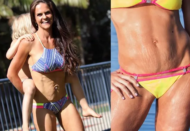 Madre de 6 hijos y muestra orgullosa su cuerpo con estrías