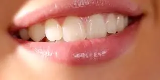 ¿Por qué los dientes cambian de color?