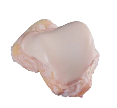 rodillas