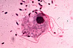 hiv