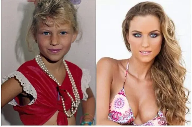 El antes y después de algunos artistas venezolanos