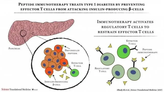 Demuestran la seguridad d la inmunoterapia para la diabetes