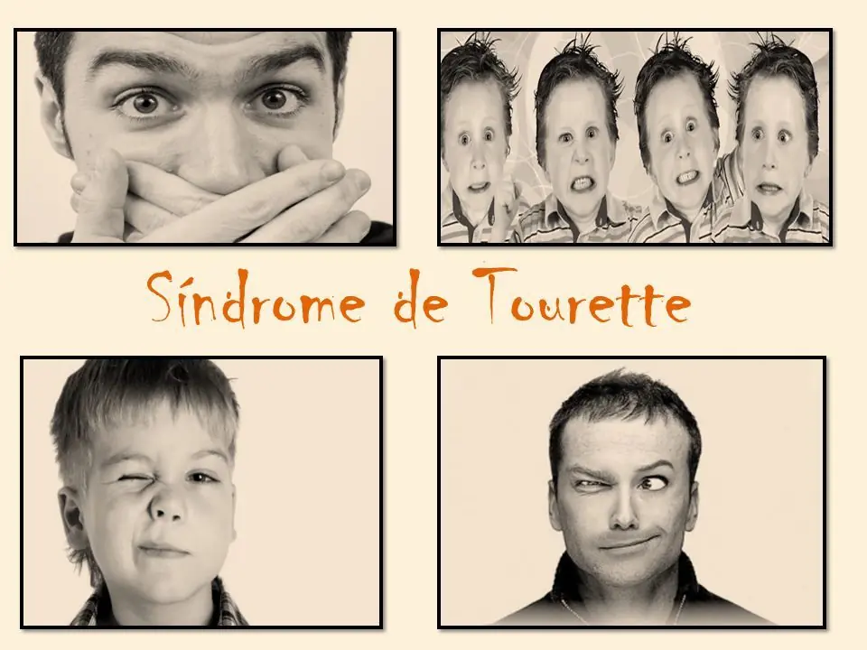 Síndrome de Tourette