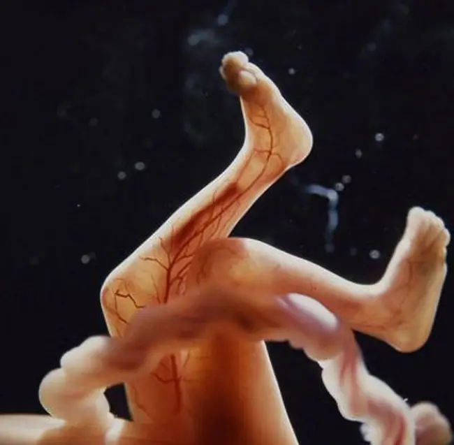 humana