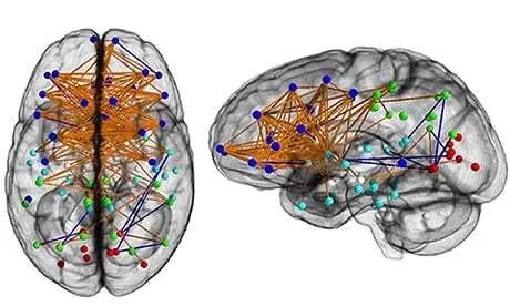 Mapa de conexiones neuronales de hombre y mujer