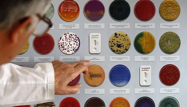Microbios intestinales desarrollan la esclerosis múltiple